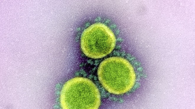 Transmission electron micrograph of SARS-CoV-2 virus particles, isolated from a patient.